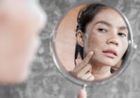 woman inspecting dark spots on the skin