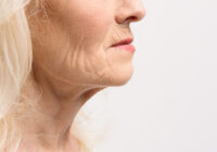 older woman with skin wrinkles