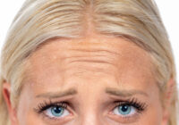 blonde woman with frown lines eyebrows