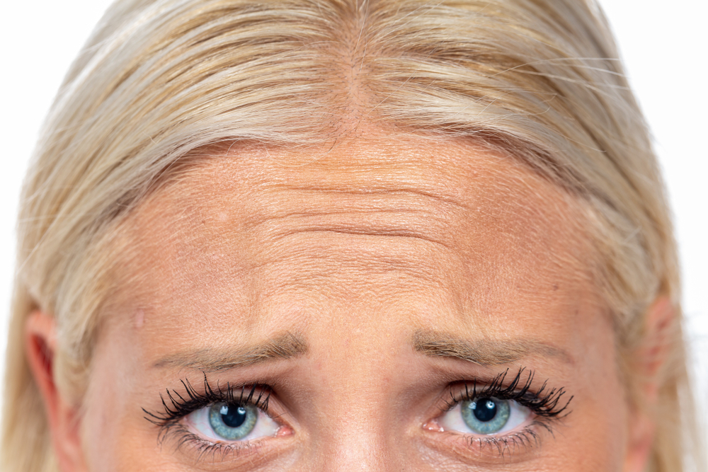 Dysport Injections: The Cure to Frown Lines