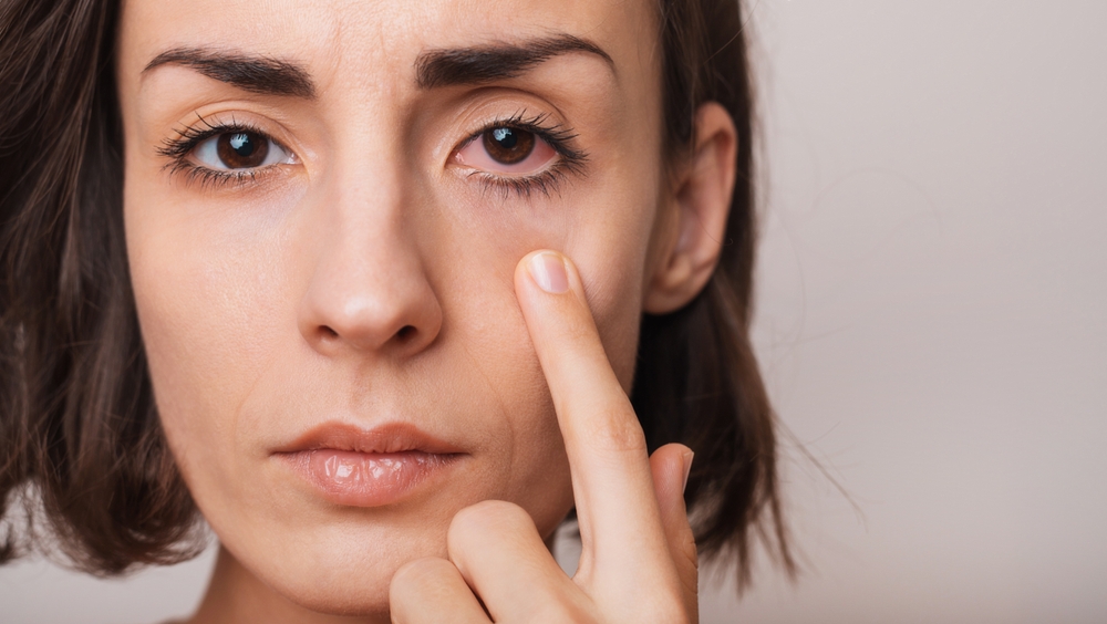 Relief for Dry Eyes: Understanding and Managing the Discomfort