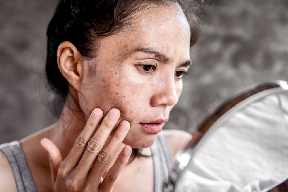 The Ultimate Skincare Routine for Oily Skin