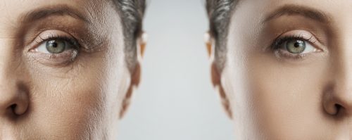 The Role of Genetics in Skin Elasticity and Aging